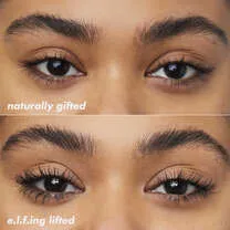 Brow Lift